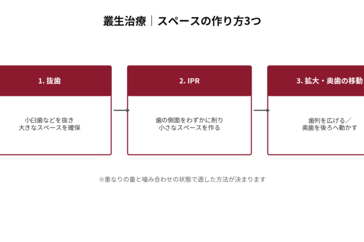 叢生（歯のガタガタ）治療におけるスペースの作り方3つを示した図。1.抜歯（小臼歯などを抜いて大きなスペースを確保）、2.IPR（歯の側面をわずかに削って小さなスペースを作る）、3.拡大・奥歯の移動（歯列を広げる、または奥歯を後ろへ動かす）。重なりの量と噛み合わせの状態によって適した方法が決まる旨を注記。