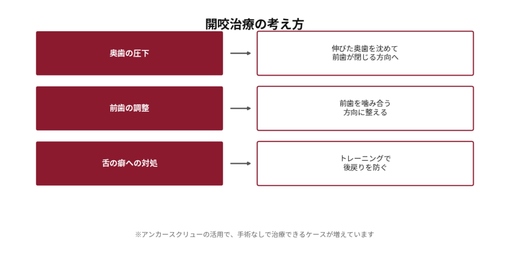 開咬（前歯が閉じない）治療の考え方を示した図。奥歯の圧下により伸びた奥歯を沈めて前歯が閉じる方向へ導く。前歯の調整で前歯を噛み合う方向に整える。舌の癖にはトレーニングで対処して後戻りを防ぐ。アンカースクリューの活用により、手術なしで治療できるケースが増えている旨を注記。