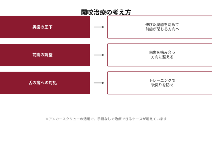 開咬（前歯が閉じない）治療の考え方を示した図。奥歯の圧下により伸びた奥歯を沈めて前歯が閉じる方向へ導く。前歯の調整で前歯を噛み合う方向に整える。舌の癖にはトレーニングで対処して後戻りを防ぐ。アンカースクリューの活用により、手術なしで治療できるケースが増えている旨を注記。