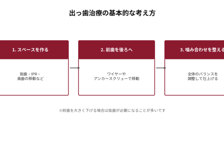 出っ歯治療の基本的な考え方を3ステップで示した図。1.スペースを作る（抜歯・IPR・奥歯の移動など）、2.前歯を後ろへ（ワイヤーやアンカースクリューで移動）、3.噛み合わせを整える（全体のバランスを調整して仕上げる）。前歯を大きく下げる場合は抜歯が必要になることが多い旨を注記。
