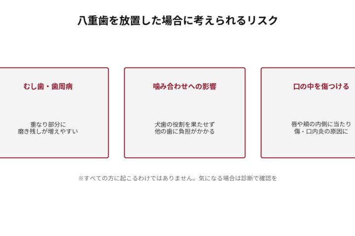 八重歯を放置した場合に考えられるリスクを3つ示した図。むし歯・歯周病（重なり部分に磨き残しが増えやすい）、噛み合わせへの影響（犬歯の役割を果たせず他の歯に負担がかかる）、口の中を傷つける（唇や頬の内側に当たり傷・口内炎の原因になる）。すべての方に起こるわけではない旨を注記。