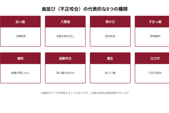 歯並び（不正咬合）の代表的な8つの種類を一覧にした図。出っ歯（上顎前突）、八重歯（犬歯の飛び出し）、受け口（反対咬合）、すきっ歯（空隙歯列）、開咬（前歯が閉じない）、過蓋咬合（深い噛み合わせ）、叢生（乱ぐい歯）、口ゴボ（口元の突出）を並べて示す。複数のタイプを併発することもあり、正確な診断は精密検査で行う旨を注記。