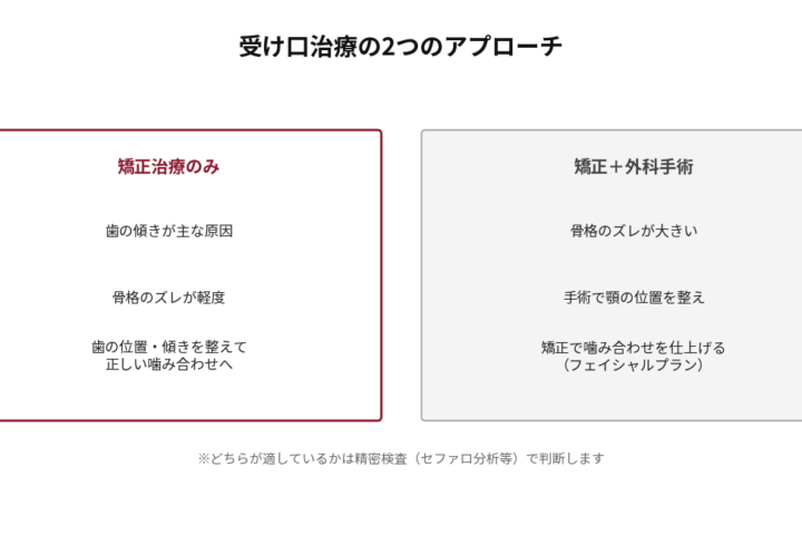 受け口治療の2つのアプローチを比較した図。矯正治療のみで対応する場合は、歯の傾きが主な原因で骨格のズレが軽度なケースで、歯の位置と傾きを整えて正しい噛み合わせへ導く。矯正＋外科手術の場合は、骨格のズレが大きいケースで、手術で顎の位置を整えたうえで矯正により噛み合わせを仕上げる（フェイシャルプラン）。どちらが適するかは精密検査（セファロ分析等）で判断する旨を注記。